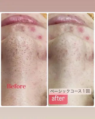 エステセレニティー 山本美樹のエステ・リラクイメージ