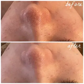 メンズ メナード岐阜市茜部 杉浦のエステ・リラクイメージ