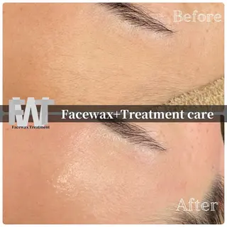 韓国肌管理 白玉肌管理®︎のエステ・リラクイメージ