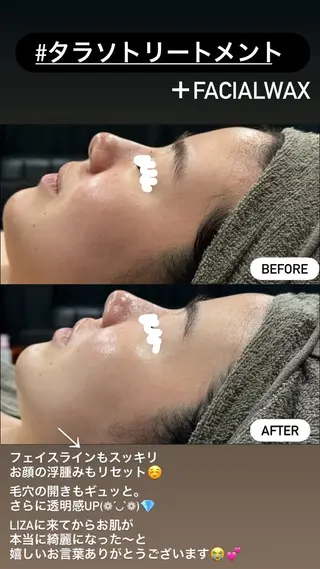 LiZA エステティックサロンのエステ・リラクイメージ