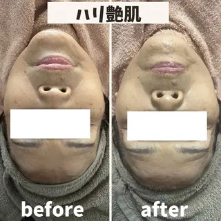 ReN所属・ReN エステサロンのエステ・リラクイメージ