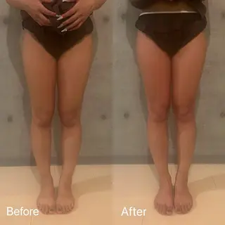 肥後橋INDIBA Salon Calmのその他イメージ