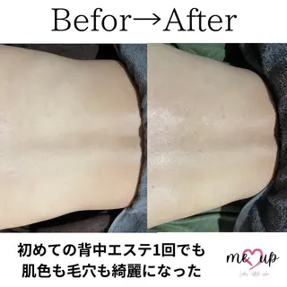 Meupニキビ専門店 背中/ハーブ/肌管理のその他イメージ
