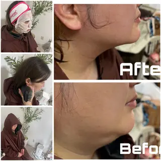 【敏感肌管理×小顔サロン】Belle orchid所属・敏感肌×小顔サロン 玲央奈のエステ・リラクイメージ