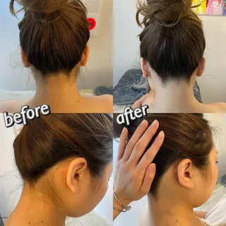 うなじ脱毛/美肌脱毛 LABELのエステ・リラクイメージ