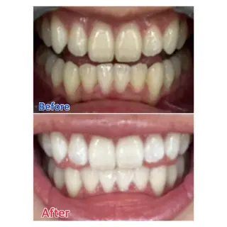 MBEAUTYSALON 千葉店・京成大久保所属・Melty 輝のその他イメージ