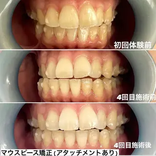 ホワイトニング専門店 Hi-Whiteのその他イメージ