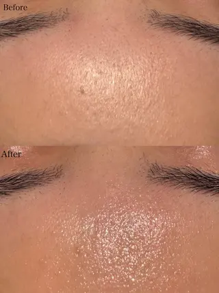 beautysalon LIMOA所属・松本 愛絵理のエステ・リラクイメージ