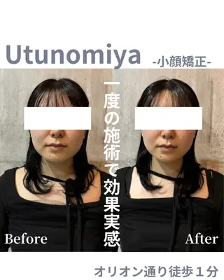 Men's Nail Vitip所属・sekiyama junnaのエステ・リラクイメージ