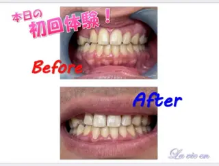 セルフホワイトニングサロン　ラヴィアン所属・ホワイトニングサロン La vie enのその他イメージ