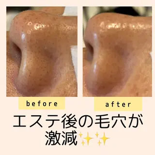 小顔・毛穴・たるみ ネイル　似内真樹のエステ・リラクイメージ