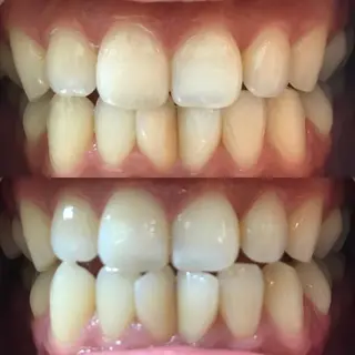 ミディアム カラー パーマ ヘアアレンジ ネイル マツエク・マツパ アイブロウ LBSホワイトニング 🌐梅田店公式のその他イメージ