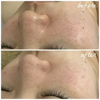 メンズ メナード岐阜市茜部 杉浦のエステ・リラクイメージ