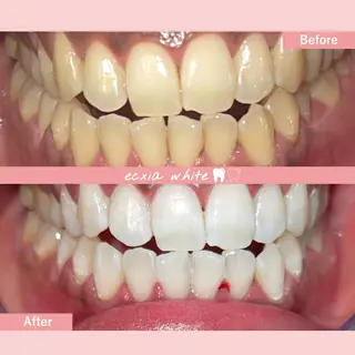 セルフホワイトニング エクシア中島公園店のその他イメージ