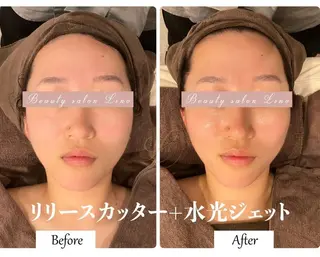 ブライダルサロン ｜Lino【堀江】のエステ・リラクイメージ