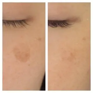 M. lisyelのエステ・リラクイメージ