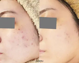 ASHERU* Yuiのエステ・リラクイメージ