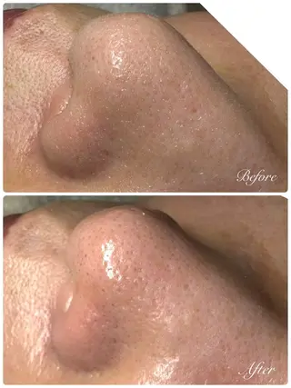 estheticsalon Pleroma【プレローマ】所属・【脱毛･美肌サロン】 Pleromaのエステ・リラクイメージ