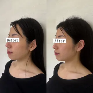 Private salon La.所属・Stellum 小顔矯正&ヘッドスパのエステ・リラクイメージ