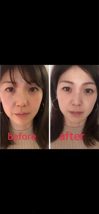 美容鍼灸サロン mahoroba院長のエステ・リラクイメージ