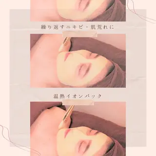 都内で出来る肌管理！ 最短ニキビ改善のエステ・リラクイメージ