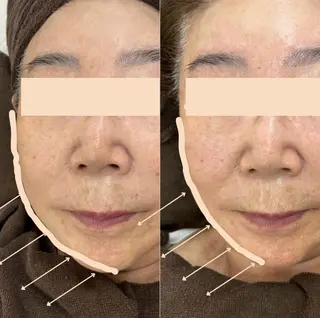 エステサロンMee. 大畑のエステ・リラクイメージ