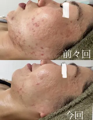 Beauty   Salon  Adiy所属・Adiy ikumiのエステ・リラクイメージ