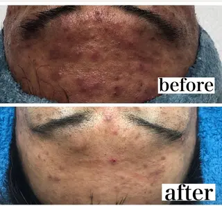 メンズ beauty salonnのエステ・リラクイメージ