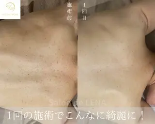 サロンドレナ名駅店所属・ハーブピーリング専門 サロンドレナ平岡のエステ・リラクイメージ