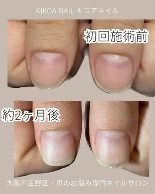 ネイル KIKOA NAIL キコアネイルのネイルデザイン