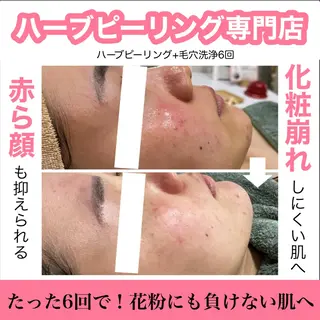 ハーブピーリング専門 muro.のエステ・リラクイメージ