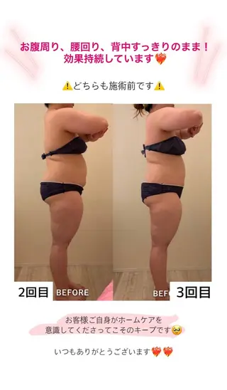 産後ダイエット−9㎏ Pourvous結衣のエステ・リラクイメージ
