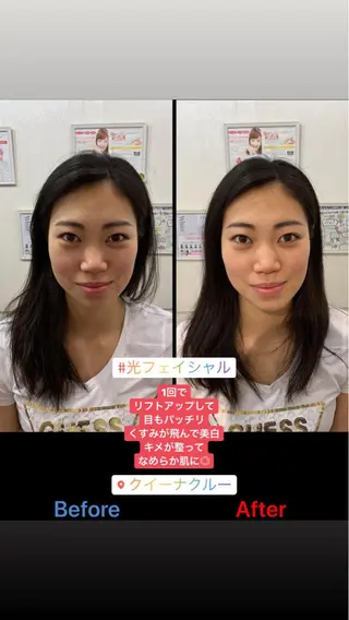 ロング カラー ヘアアレンジ ネイル マツエク・マツパ 毛穴改善/脱毛 ネイル　川上久仁子のエステ・リラクイメージ