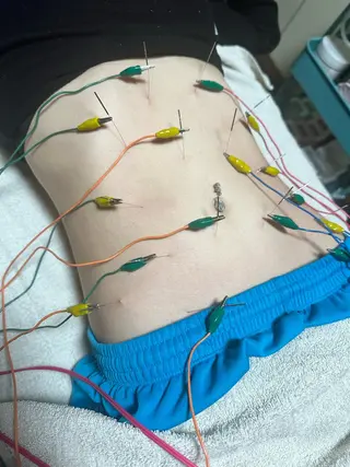 はりすたいる 鍼灸院のエステ・リラクイメージ