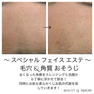 ビューティー ミロワールのエステ・リラクイメージ
