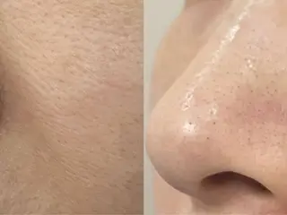 マツエク・マツパ aliaハイフ&水光ジェットサロン所属・aliaハーブ水光店 エステティシャン募集のエステ・リラクイメージ