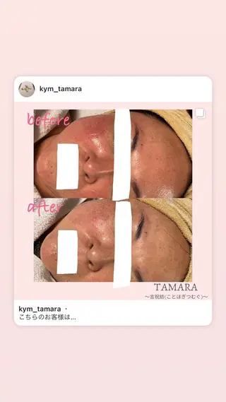 TAMARA 松下のエステ・リラクイメージ