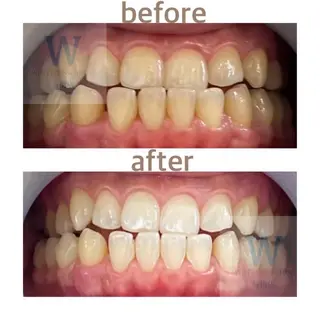 ホワイトニング ショップ船橋２号店のエステ・リラクイメージ