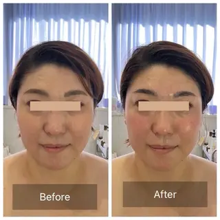 第一印象専門サロン ADISEのエステ・リラクイメージ