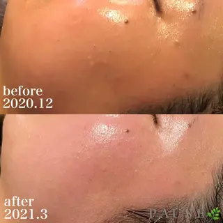 浜野 恵美のエステ・リラクイメージ