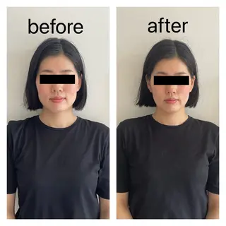 小顔矯正・美容鍼 FLOW鍼灸整体院のエステ・リラクイメージ