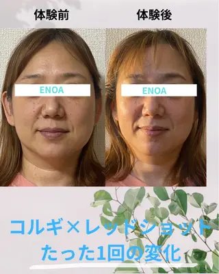 ENOA所属・コルギ/全身リンパ saoriのエステ・リラクイメージ