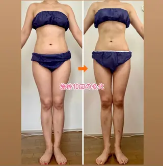 ショート カラー パーマ ヘアアレンジ メンズ キッズ ネイル マツエク・マツパ ‍痩身＆ボディ 結果出し🌟丹野のエステ・リラクイメージ