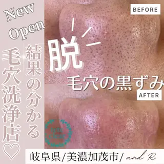 and R 男女 脱毛、毛穴サロンのエステ・リラクイメージ