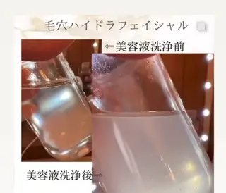 エイジングケアサロンBIOEL所属・肌質改善BIOELプ ラズマ/ラミピールのエステ・リラクイメージ