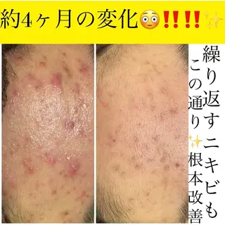ミディアム カラー パーマ ヘアアレンジ メンズ キッズ ネイル マツエク・マツパ ニキビ・肌質改善専門 ♡人生が変わるサロンのエステ・リラクイメージ
