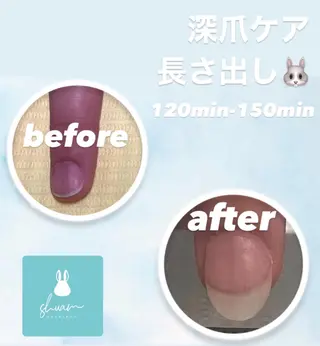 メンズ ネイル 爪ケア/深爪 自爪育成 🐰えむのネイルデザイン