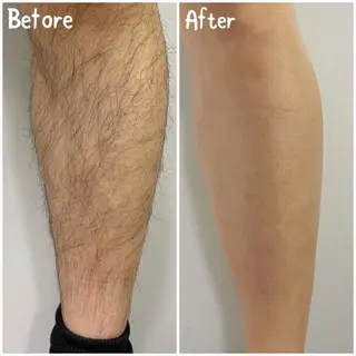 メンズ セルフ脱毛&セルフエステ　onesalon  ワンサロン姫路所属・セルフ脱毛 One Salonのエステ・リラクイメージ