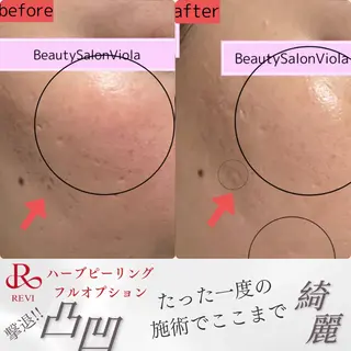 Beauty SalonViolaのエステ・リラクイメージ