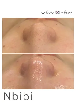 韓国🇰🇷価格 サロン_Nbibiのエステ・リラクイメージ